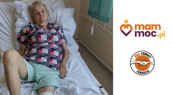 Starsza kobieta w szpitalnym łóżku z obsadą.