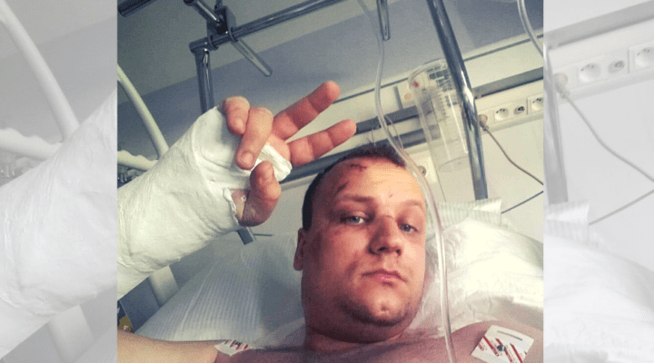 Mężczyzna w szpitalnym łóżku z ręką w obsadzie.