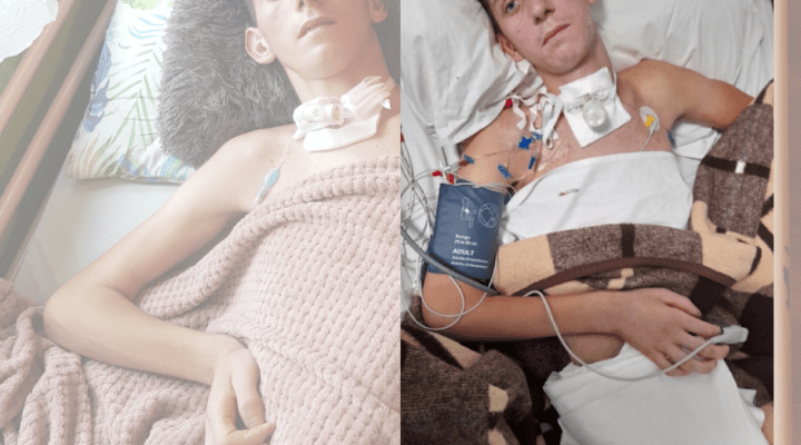 Dwa zdjęcia mężczyzny w szpitalnym łóżku.