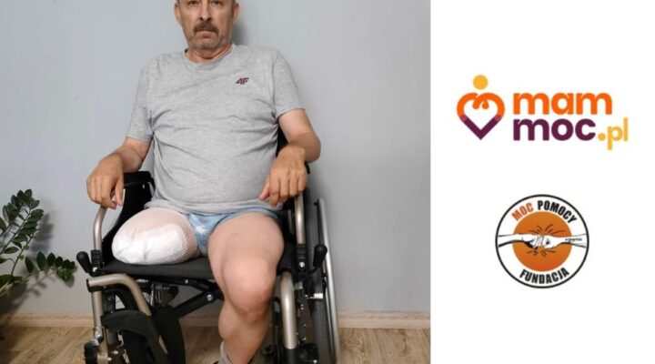 Mężczyzna na wózku inwalidzkim z obsadą na nodze.