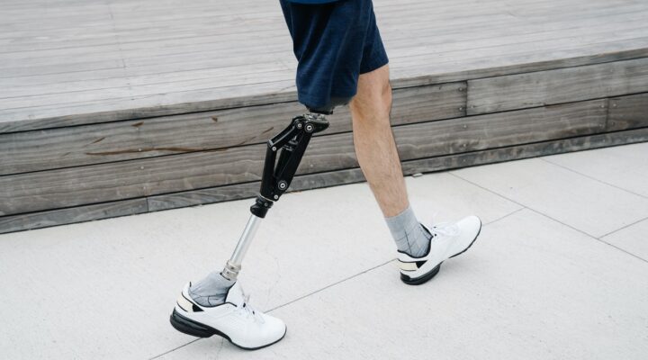 Osoba z protetyczną nogą spacerującą na chodniku.