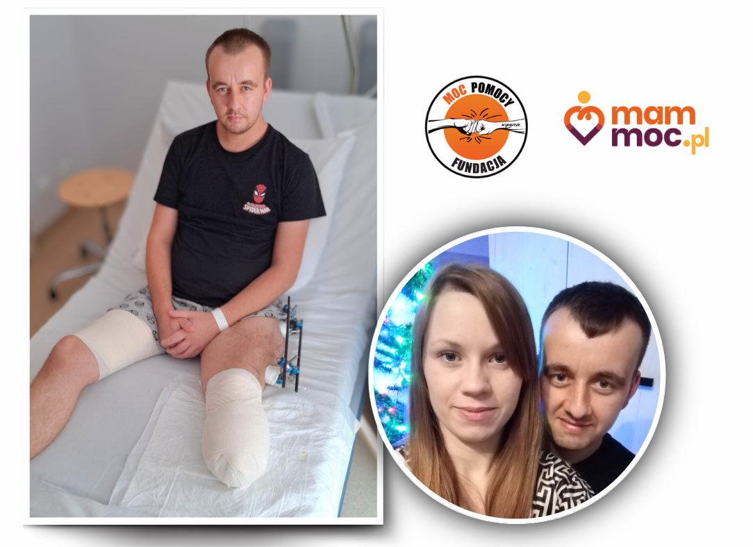 Mężczyzna w szpitalnym łóżku z obsadą na nogę i kobieta siedząca obok niego.