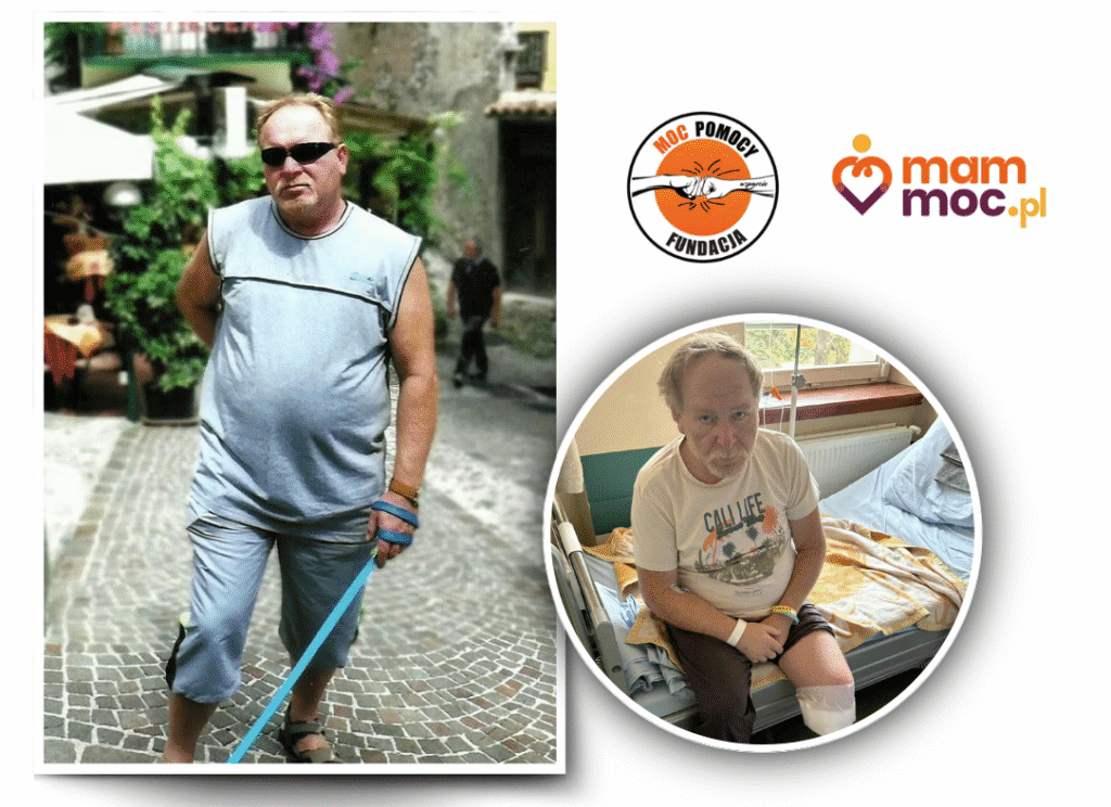 Na zdjęciu po lewej stronie stoi mężczyzna w ciemnych okularach, najprawdopodobniej jest w trakcie zwiedzania. Na drugim zdjęciu ten sam mężczyzna siedzi na szpitalnym łóżku, z zamyśloną miną. Jest po amputacji lewego podudzia.