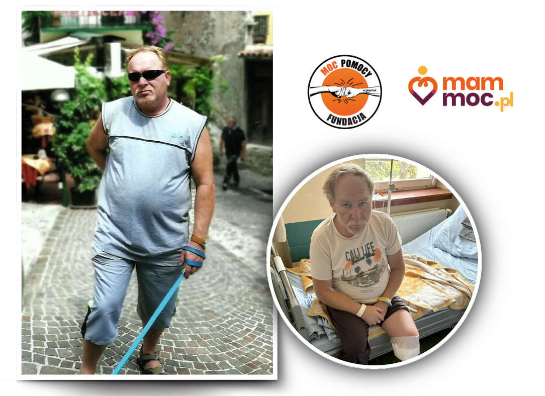 Na zdjęciu po lewej stronie stoi mężczyzna w ciemnych okularach, najprawdopodobniej jest w trakcie zwiedzania. Na drugim zdjęciu ten sam mężczyzna siedzi na szpitalnym łóżku, z zamyśloną miną. Jest po amputacji lewego podudzia.